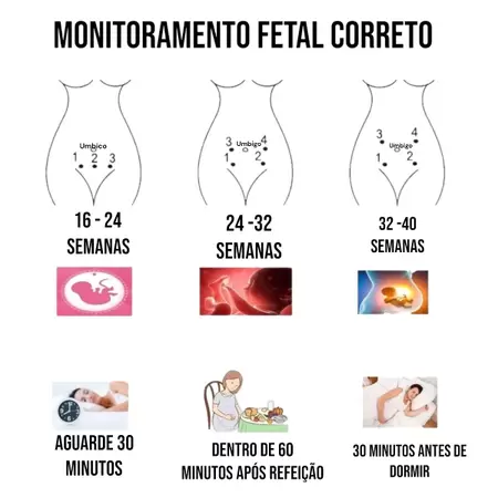 Doppler Fetal Ultrasónico - Monitor de ritmo cardíaco do bebé - Image 2